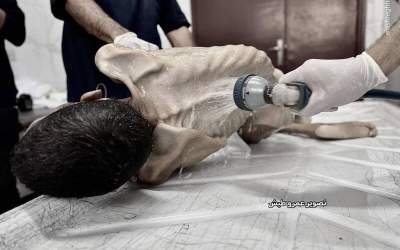 شهادت نوزاد فلسطینی بر اثر سوءتغذیه شدید  <img src="https://cdn.jahannews.com/images/video_icon.png" width="16" height="16" border="0" align="top">