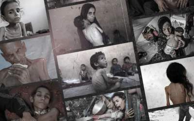 این ویروس جدید در غزه جان کودکان را می‌مکد