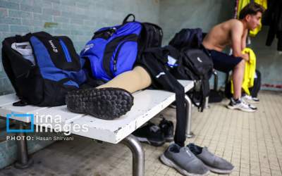 عکس/ پایی که جا ماند!