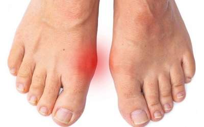 درد شست پا می‌تواند نشانه بیماری‌های جدی باشد