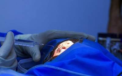 عوارض خطرناک تتوی قرنیه چیست؟