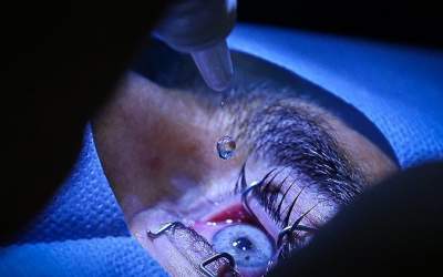 چند درصد مردم دچار خشکی چشم هستند؟