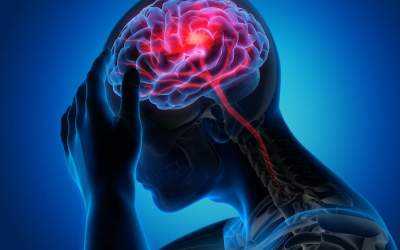 سکته مغزی دومین عامل مرگ در کشور