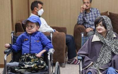 شناسایی ۱۲۵۰ بیمار پروانه‌ای در کشور