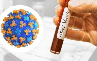 هشدار؛ آلودگی هوا ویروس H۳ را خطرناک‌تر کرد