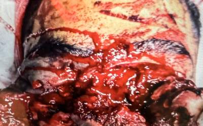 تصاویر دردناک  