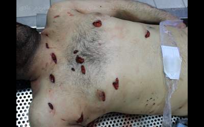 دیدن تصاویر این گزارش برای هر کسی مناسب نیست/ تروریست‌ها هیچ رحمی به مردم عادی نکردند/ بدن‌هایی که با قمه، دشنه و چاقو‌های بلند سوراخ‌سوراخ شده‌اند  