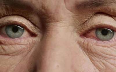 پیرچشمی چیست و چه زمانی بروز می‌کند؟